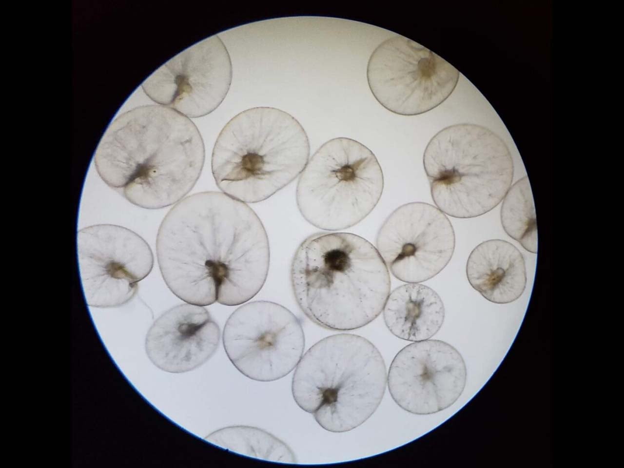 Plankton in a microscope